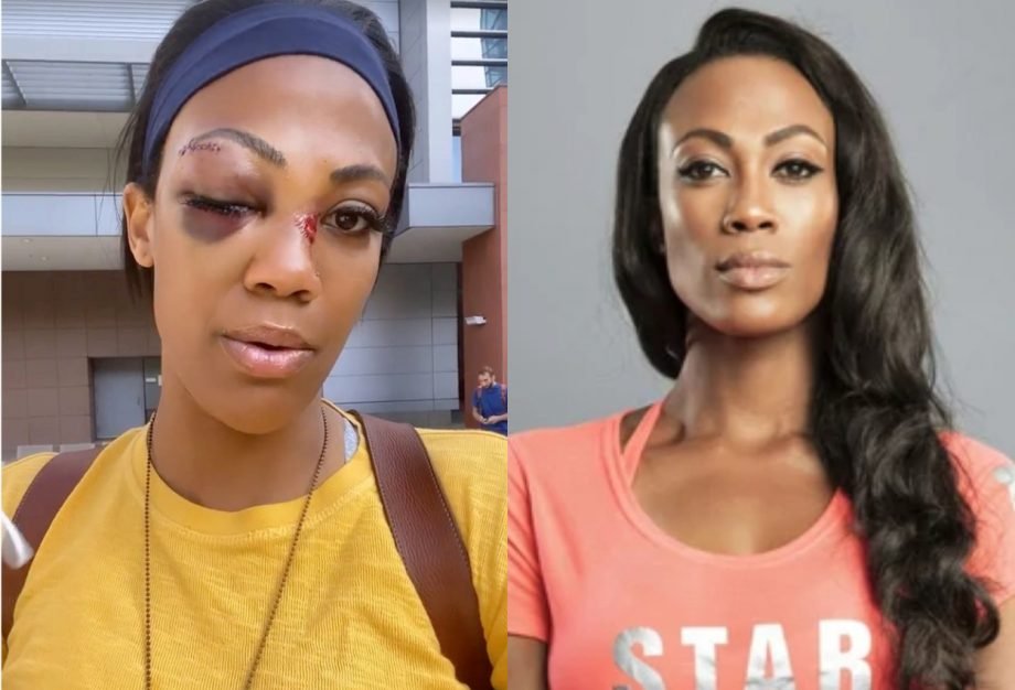 Olympic Silver Medalist Kim Glass Attacked By Homeless Man In Los Angeles